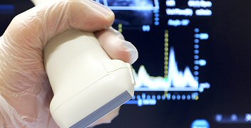 Ultrassom