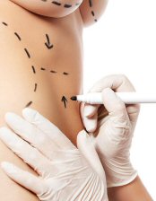 Cirurgia Plástica